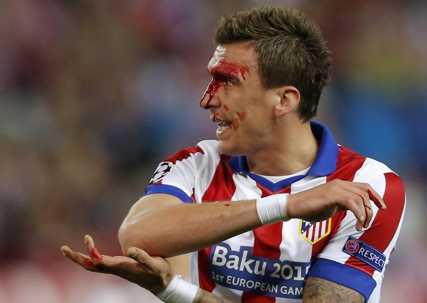 Mandzukic, colpito da una gomitata di Ramos, ha il volto insanguinato. Ap
